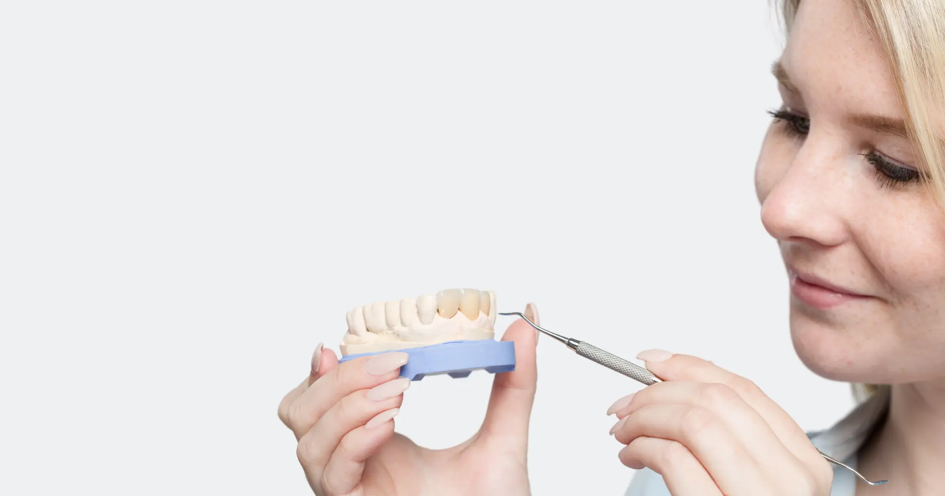 Dental crowns kitchener