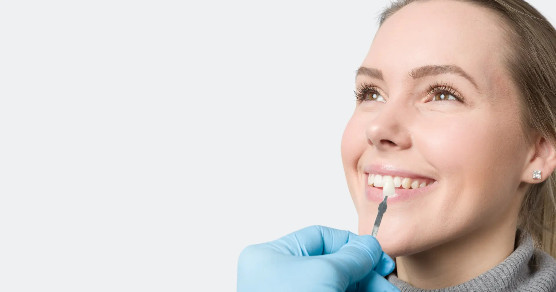 Porcelain veneers kitchener