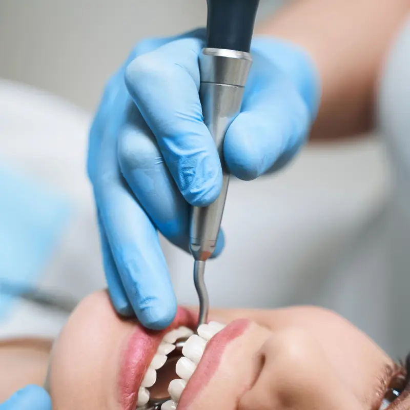 Endodontics Kitchener — Walk In The Park Family Dental