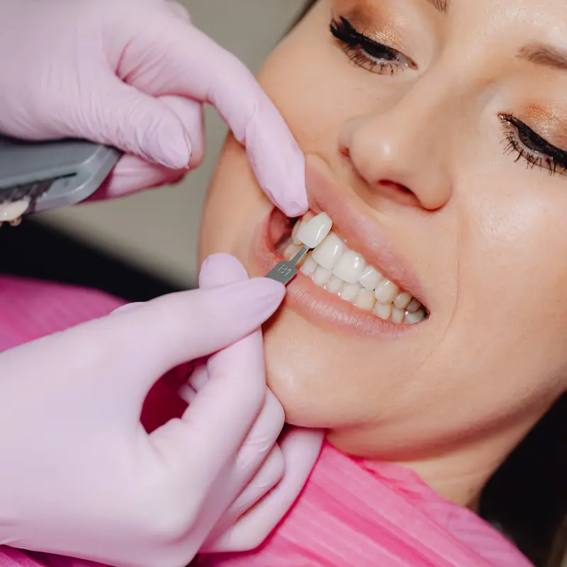 Dentist checking veneer shade on a patient’s front tooth at Walk in the Park Family Dental in Kitchener