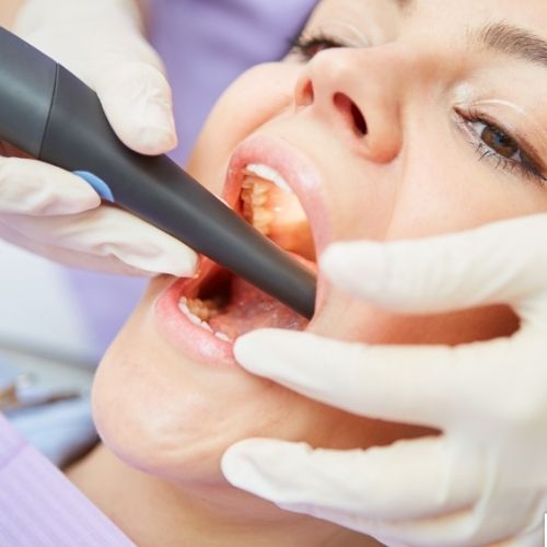 Dentist using an intraoral scanner to capture digital impressions at Walk in the Park Family Dental in Kitchener